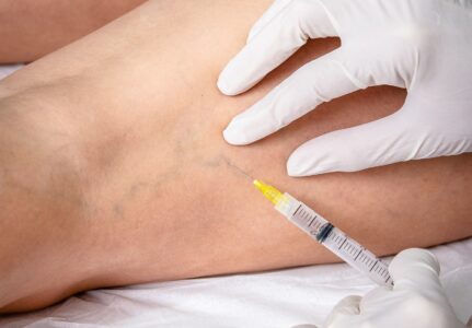 Clinica Médica Vascular em Sorocaba