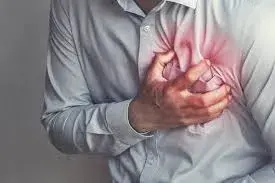 Tratamento para Doença Arterial Coronária
