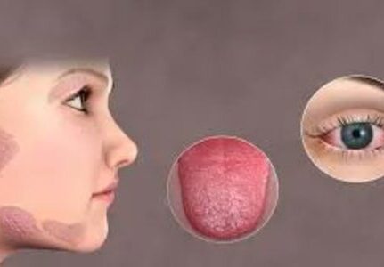 Reumatologista que trata Síndrome de Sjögren