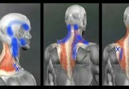 Reumatologista que trata síndrome miofascial