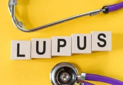 Médico especialista em tratamento de lúpus