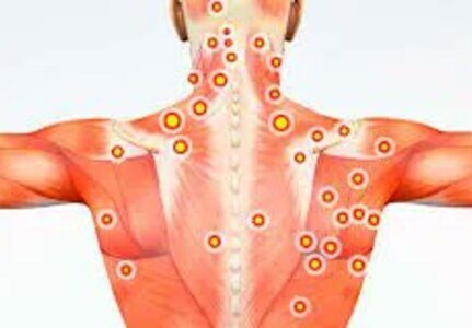 O melhor médico para tratamento de síndrome miofascial