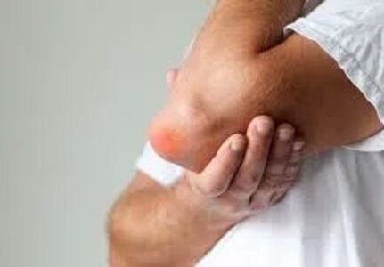 O melhor médico para tratamento de bursite