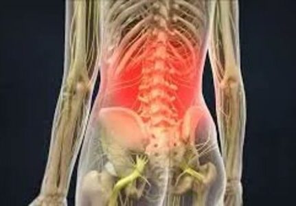 Médico especialista em dor na lombar