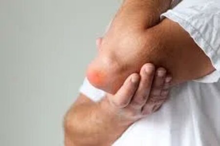 Tratamento para Bursite em SP