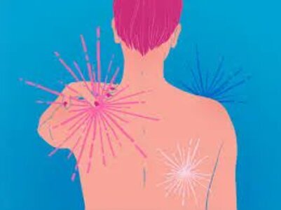 Reumatologista que trata fibromialgia