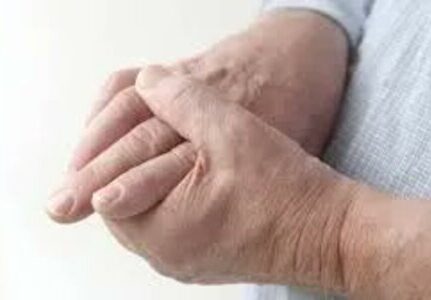 O melhor reumatologista para tratamento de dor nas articulações