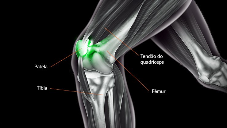 Tratamento para tendinite no joelho