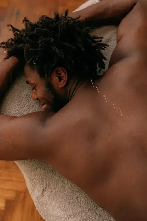 Acupuntura em Guarulhos