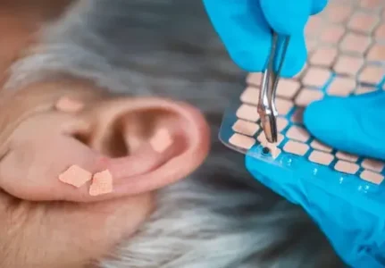 Auriculoterapia em Guarulhos